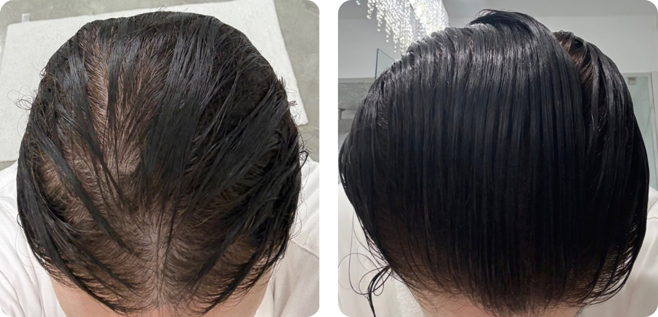 Before and after result from verified customer