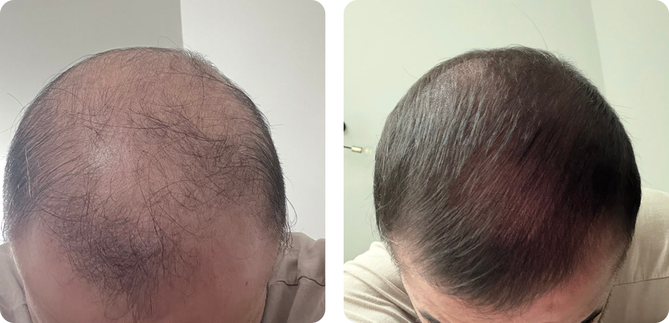Before and after result from verified customer