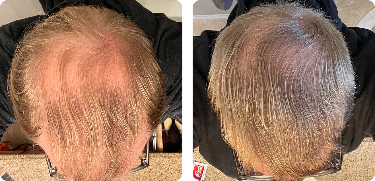 Before and after result from verified customer