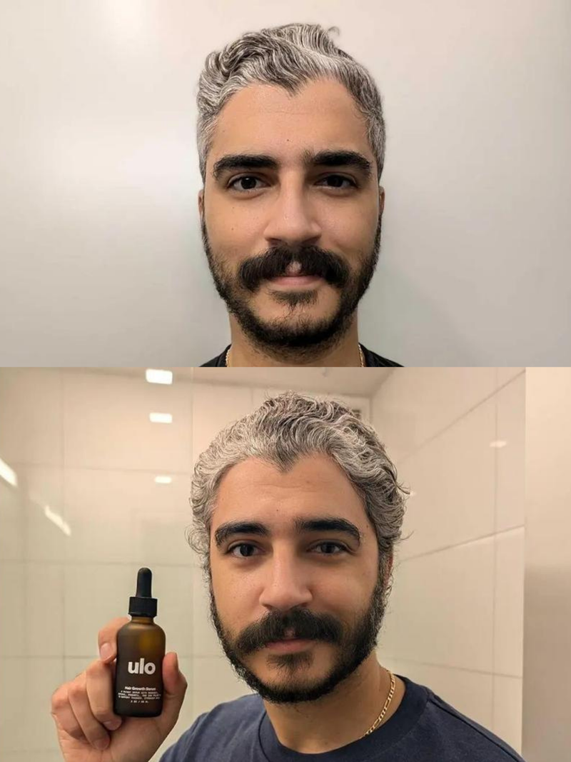 Natural Hair Growth Serum Natural Hair Growth Serum