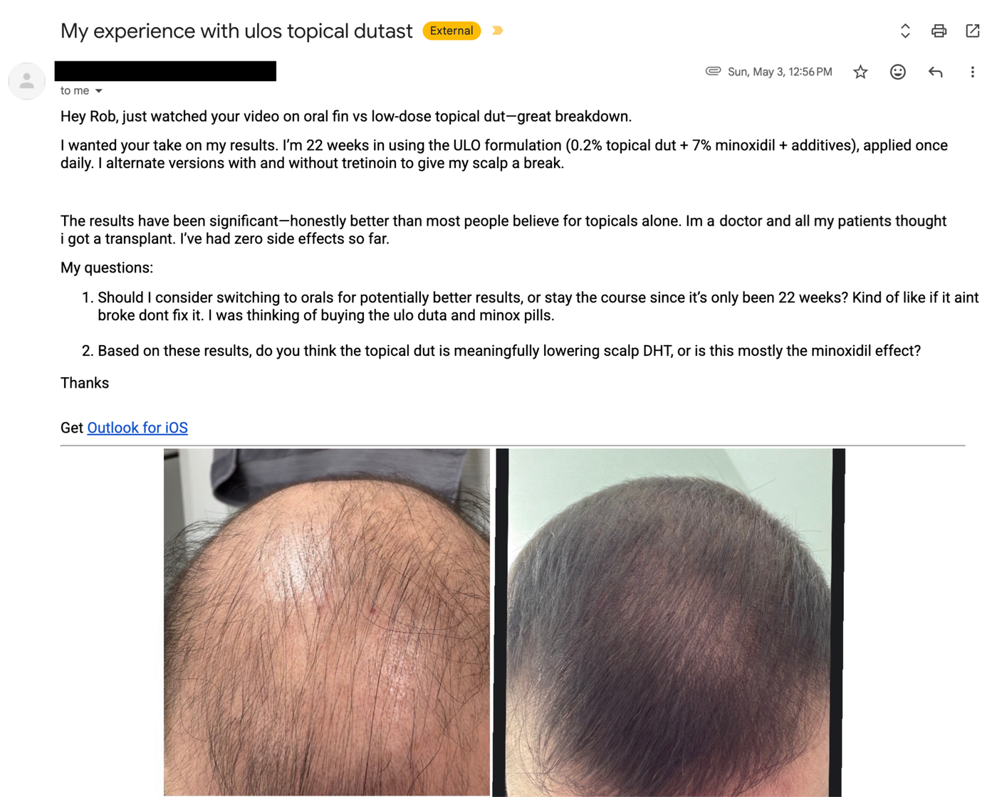 Customer before and after result