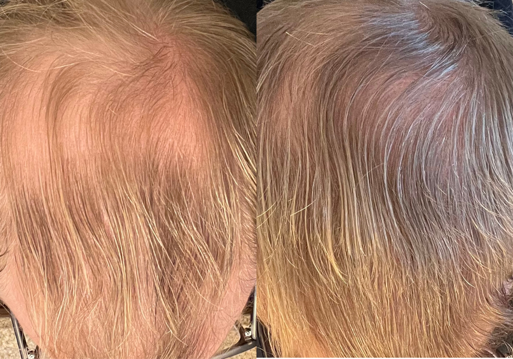Before and after results 2