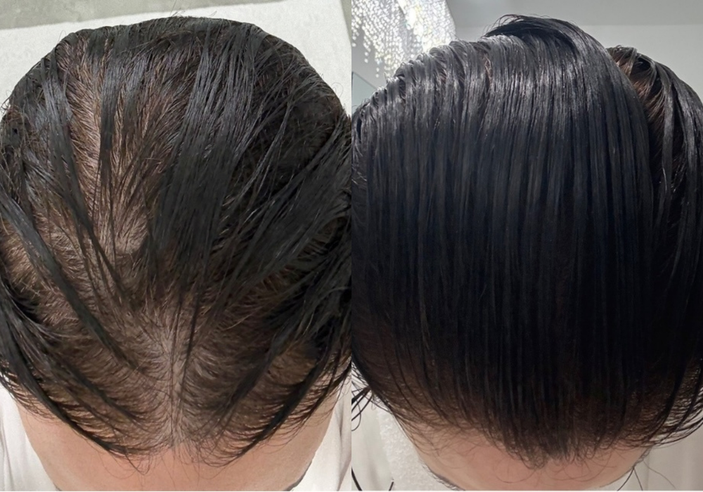 Before and after results 1