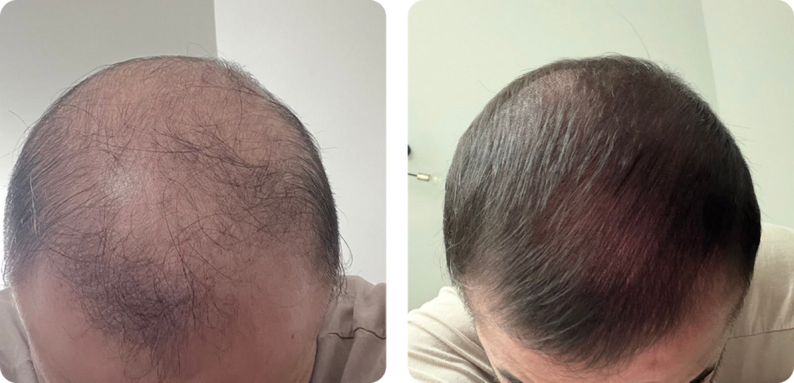 Anonymous before and after