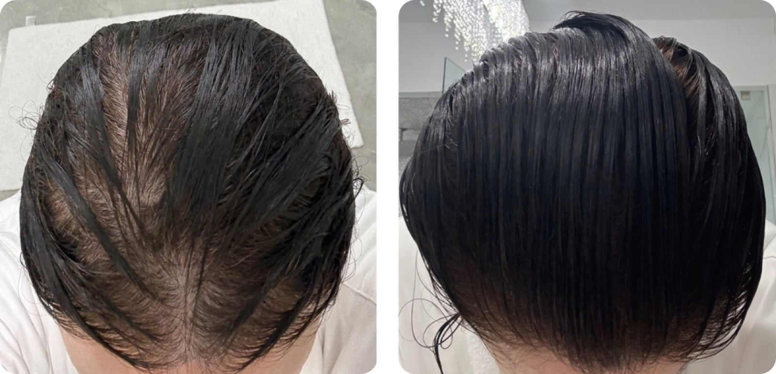 Shalimar before and after