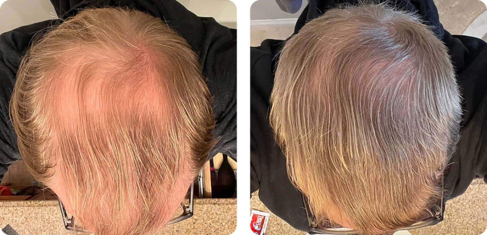 David before and after